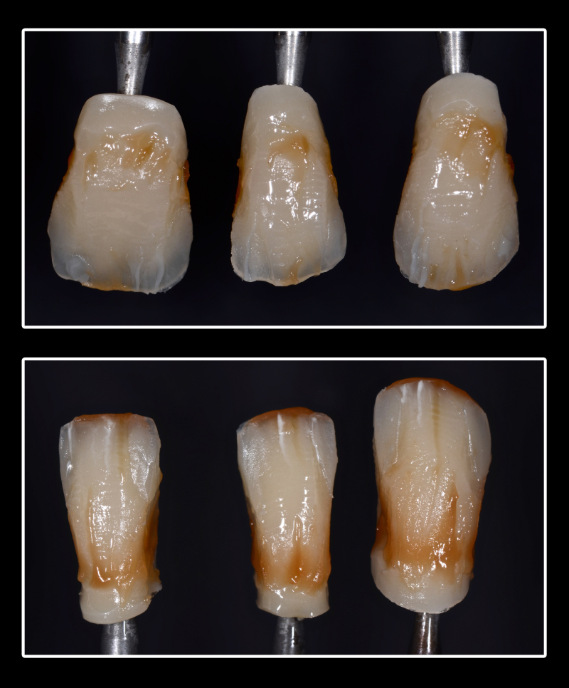 stratificazione caratterizzazioni