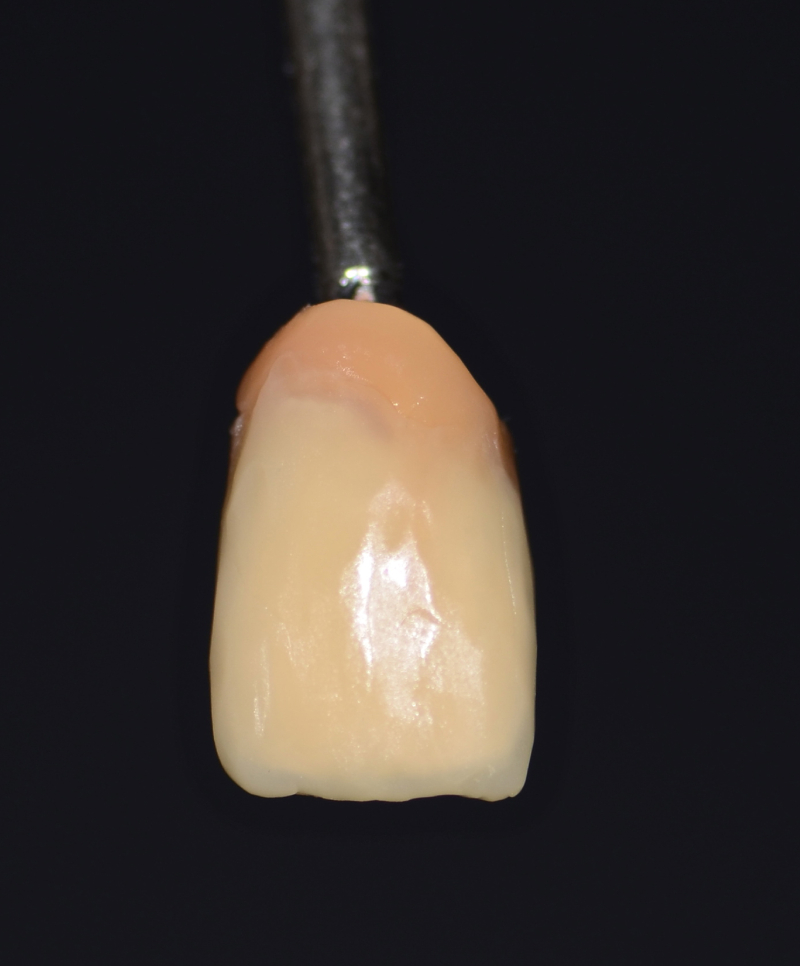 stratificazione corpo dente