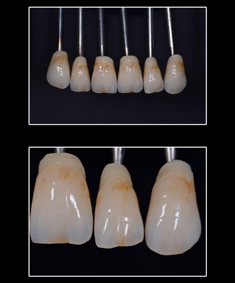 stratificazione rifinitura e lucidatura